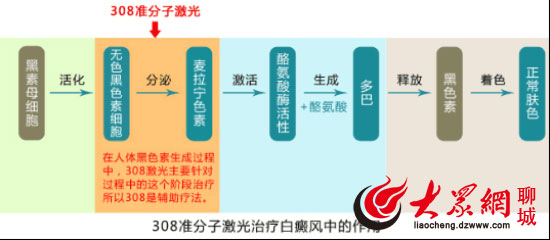 白癜风医院权威专家深度解析308准分子激光_